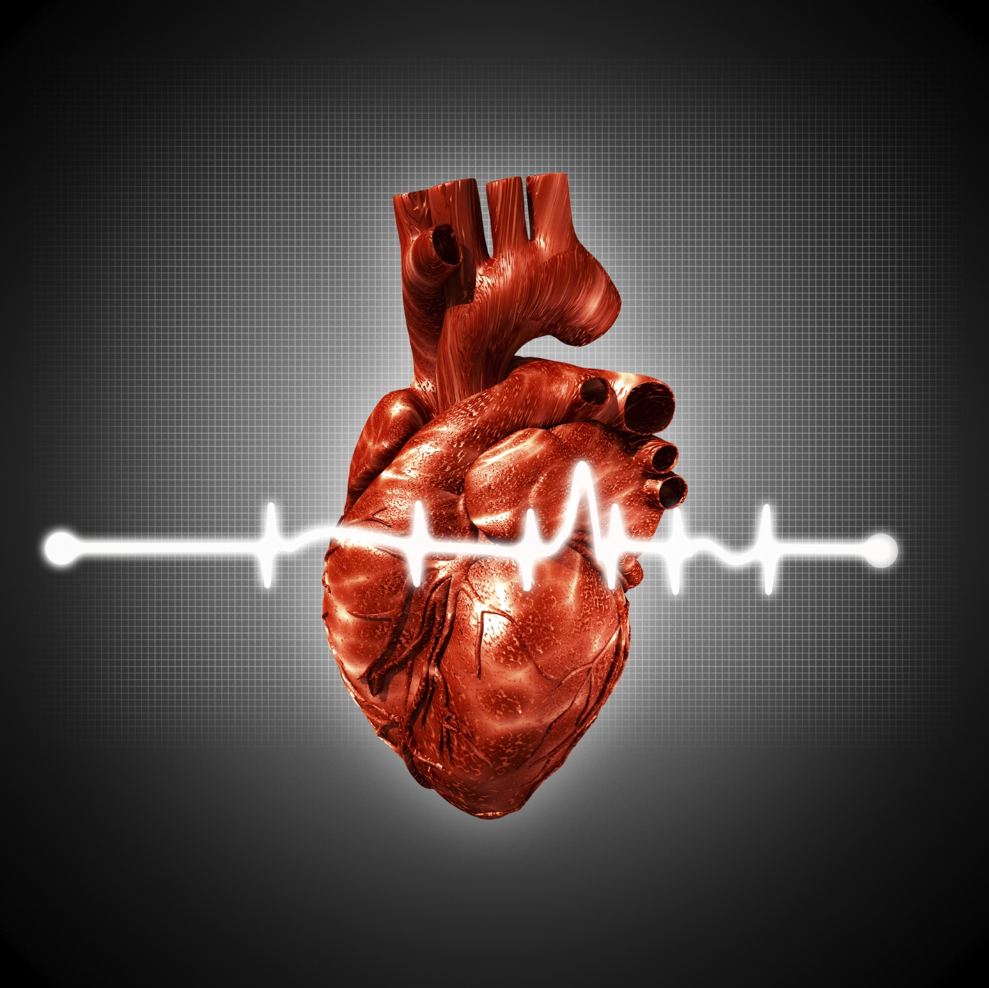 Are Heart Palpitations A Precursor To A Heart Attack