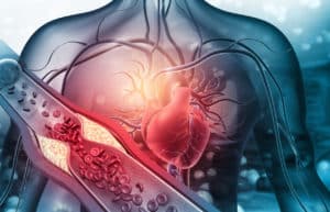 heart health issues associated with high blood pressure