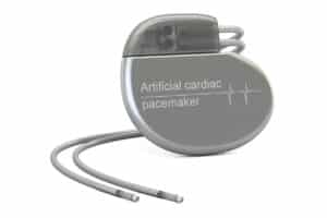 advances in cardiology - pacemaker
