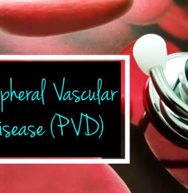 peripheral vascular disease