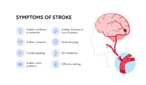 infographic discussing the symptoms of a stroke